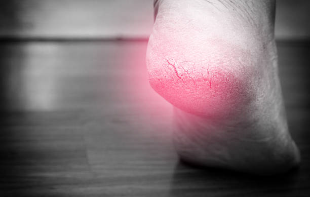 Is heel pain a sign of cancer